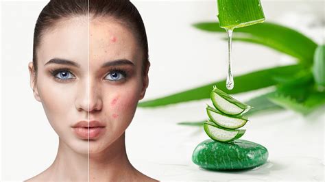Reaktion efter aloe vera i ansiktet